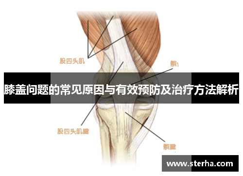 膝盖问题的常见原因与有效预防及治疗方法解析